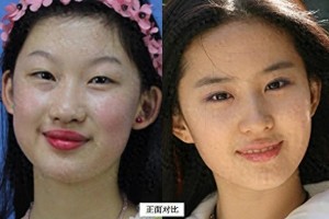19岁少女整容成刘亦菲，8年后现状揭秘